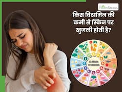 किस विटामिन की कमी से होती है खुजली? जानिए कैसे करें इसकी पूर्ति