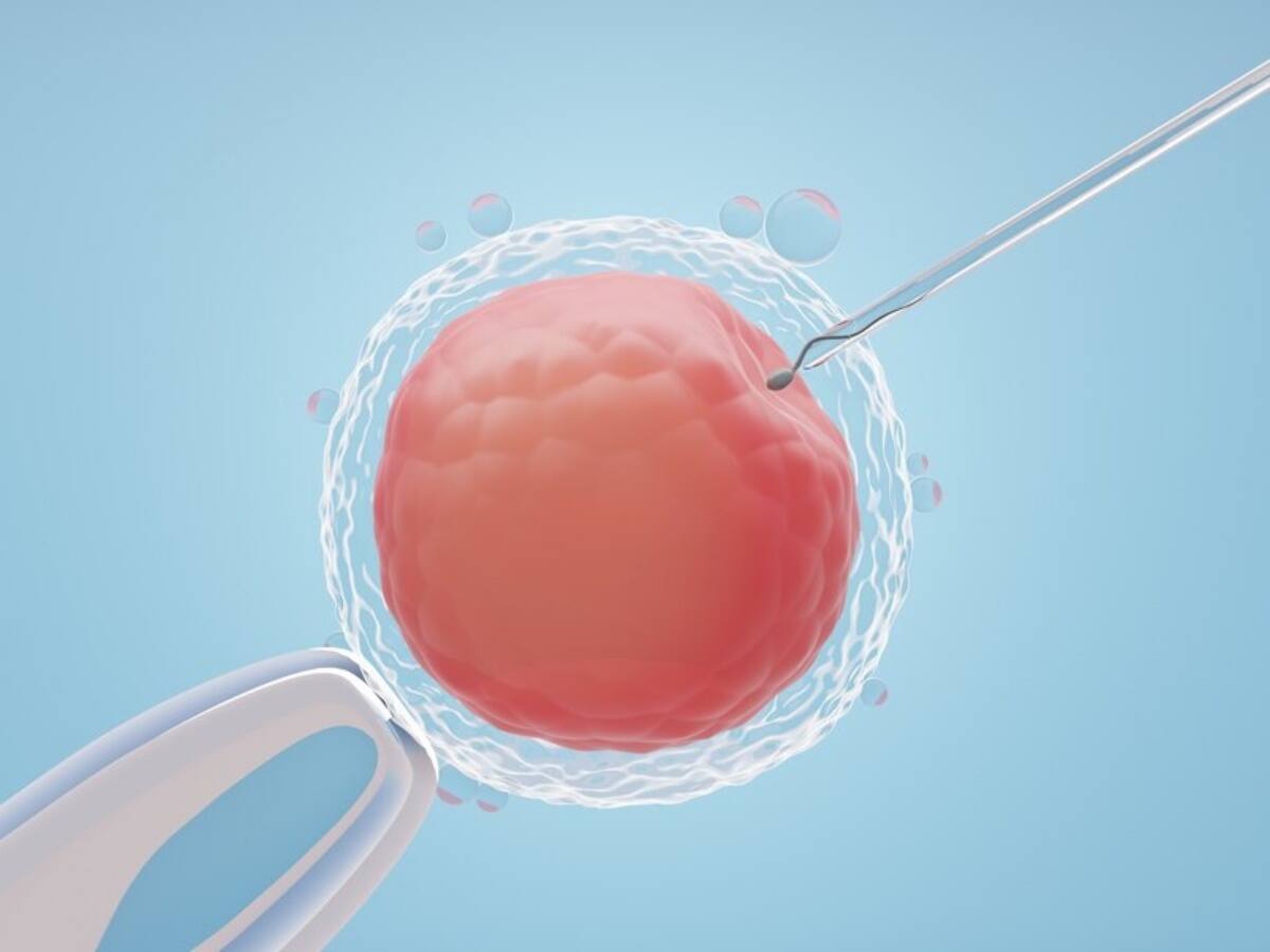 Assisted Reproductive Technology, Male infertility, infertility problem in men, Male fertility problem, infertility problems in men, infertility issues in men, infertility issues couple, in-vitro fertilization IVF, dealing with male infertility