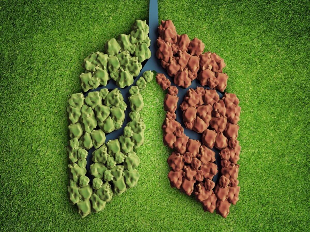 climate change hazards, Fight Against Pneumonia, Pneumonia, Air Pollution, Pneumonia Awareness, burden of pneumonia, challenges of pneumonia, pneumonia and overall health, pneumonia risk factors, air pollution and pneumonia risk