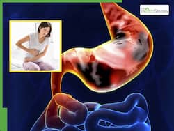 पेट में दिखने वाले ये 5 लक्षण हो सकते हैं Stomach Cancer की शुरुआत का संकेत, गलती से भी न करें इग्नोर