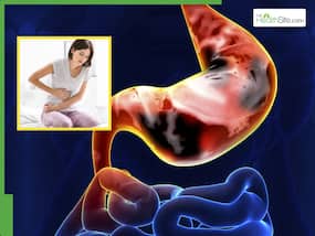 पेट में दिखने वाले ये 5 लक्षण हो सकते हैं Stomach Cancer की शुरुआत का संकेत, गलती से भी न करें इग्नोर पेट में दिखने वाले ये 5 लक्षण हो सकते हैं Stomach Cancer की शुरुआत का संकेत, गलती से भी न करें इग्नोर