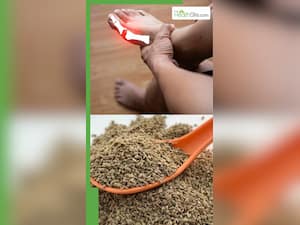 ये 8 फूड्स करेंगे बढ़े यूरिक एसिड को कंट्रोल