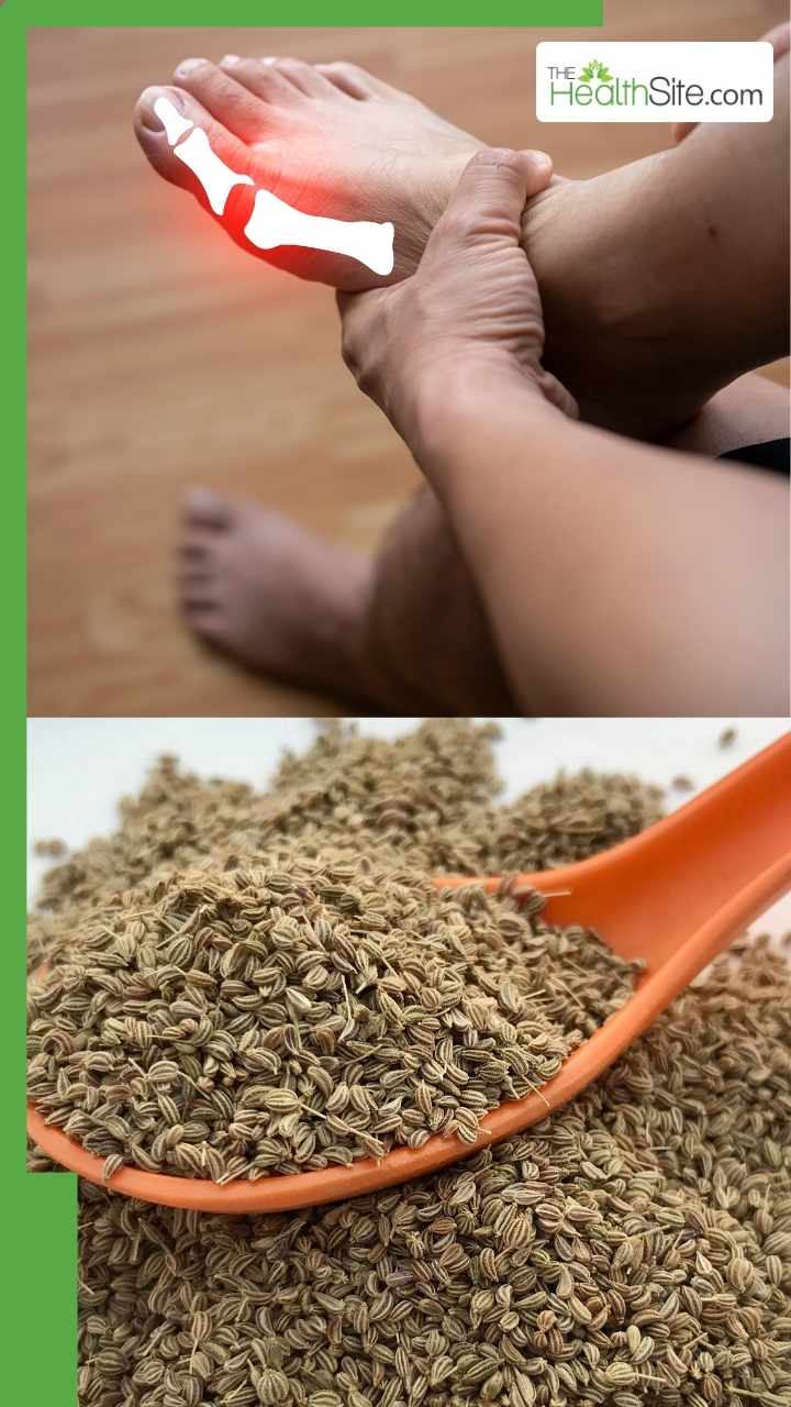 ये 8 फूड्स करेंगे बढ़े यूरिक एसिड को कंट्रोल