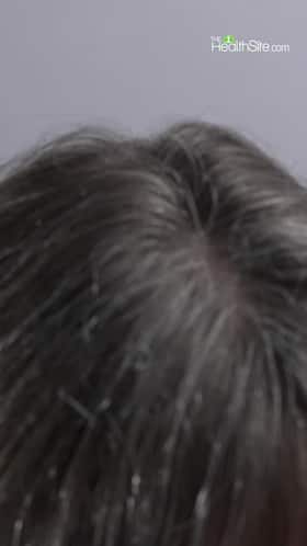 Easy way to blacken white hair