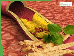 10 Medicinal Roots To Lower High Cholesterol Levels Naturally Without Medication