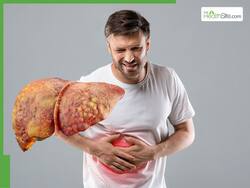 7 Foods You Should Never Eat If You Have Fatty Liver