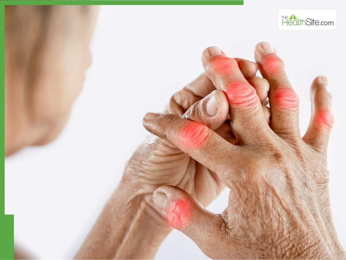 7 Proven Lifestyle Tips To Manage Arthritis Pain In Winter