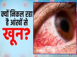 इस देश में नहीं रुक रहा आंख से खून आने का मामला, जानें कितनी खतरनाक है ये बीमारी