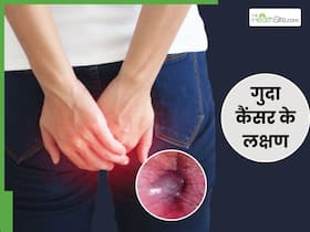 गुदा में कैंसर (Anal Cancer) होने पर शरीर में दिखाई देते हैं ये 5 लक्षण, संकेत दिखते ही भागें डॉक्टर के पास गुदा में कैंसर (Anal Cancer) होने पर शरीर में दिखाई देते हैं ये 5 लक्षण, संकेत दिखते ही भागें डॉक्टर के पास
