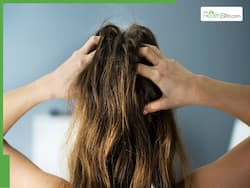 5 Best Home Remedies For Hair Growth
