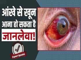 Marburg Virus: आंखों से खून आना हो सकता है इस बीमारी का लक्षण Marburg Virus: आंखों से खून आना हो सकता है इस बीमारी का लक्षण