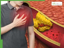 Clogged Arteries Symptoms At Night: 7 Warning Signs of High Cholesterol That Appears After 10 PM