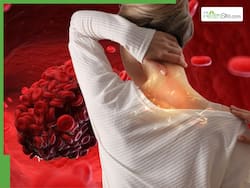 Signs of Blocked Arteries in Your Neck: 5 Indicators Your Heart Is In Real Danger