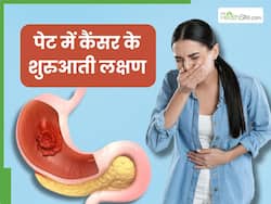 पेट में कैंसर होते ही सुबह बाथरूम में दिखने लगते हैं ये 2 लक्षण, तुरंत भागे डॉक्टर के पास