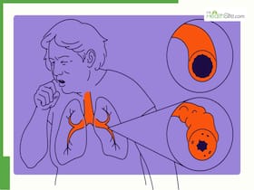 Understanding COPD: Early Detection And Prevention