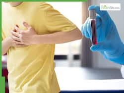 Heart Attack Prevention: 5 Blood Tests To Detect Cardiovascular Problems In Your 20s