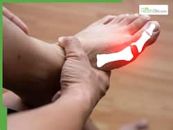 यूरिक एसिड बढ़ गया तो कौन से तेल में खाना पकाना चाहिए? एक्सपर्ट से जानिए कुकिंग ऑयल का नाम