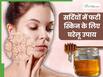 सर्दियों में फटने लगी है स्किन तो आजमाएं ये घरेलू नुस्खे, मिनटों में खिल उठेगी त्वचा