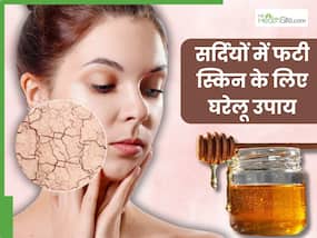 सर्दियों में फटने लगी है स्किन तो आजमाएं ये घरेलू नुस्खे, मिनटों में खिल उठेगी त्वचा सर्दियों में फटने लगी है स्किन तो आजमाएं ये घरेलू नुस्खे, मिनटों में खिल उठेगी त्वचा