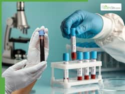 Important Blood Tests During Winter: 6 Key Screenings to Stay Healthy in Cold Weather