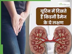 किडनी फेल होने से पहले पेशाब में दिखते हैं ये 4 संकेत, 90 फीसदी साधारण समझकर करते हैं इग्नोर