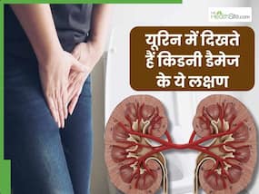 किडनी फेल होने से पहले पेशाब में दिखते हैं ये 4 संकेत, 90 फीसदी साधारण समझकर करते हैं इग्नोर किडनी फेल होने से पहले पेशाब में दिखते हैं ये 4 संकेत, 90 फीसदी साधारण समझकर करते हैं इग्नोर