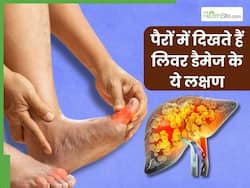 लिवर डैमेज होने से पहले पैरों में दिखाई देते हैं ये 4 लक्षण, संकेत दिखते ही तुंरत भागें डॉक्टर के पास