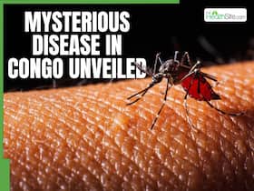 Mysterious Disease In Congo Unveiled; Know What Caused The Death Of 143 People Mysterious Disease In Congo Unveiled; Know What Caused The Death Of 143 People