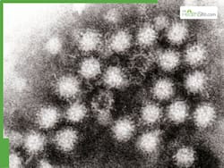 Cases Of Norovirus Surge Across The United States: CDC Data Shows