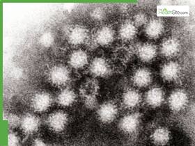 Cases Of Norovirus Surge Across The United States: CDC Data Shows Cases Of Norovirus Surge Across The United States: CDC Data Shows