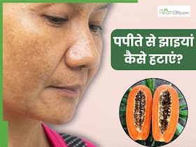 चेहरे की झाइयों को दूर करने के लिए इन 3 तरीकों से करें पपीते का इस्तेमाल, सप्ताहभर में दिखने लगेगा असर