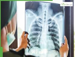 Understanding Pneumonia: Key Health Tests For Early Detection And Accurate Diagnosis
