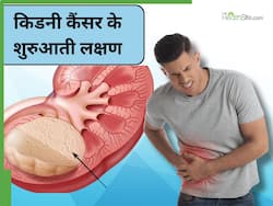 किडनी में कैंसर होते ही पेशाब में दिखने लगते हैं ये 1 लक्षण, संकेत दिखते ही भागे डॉक्टर के पास