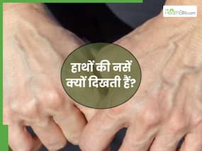 इन 5 कारणों से दिखने लगती हैं हाथों की नसें, 99 फीसदी लोग साधारण समझने की करते हैं गलती