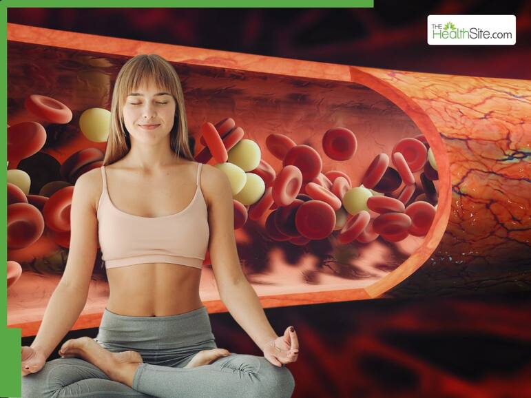 5 Yoga Asanas To Avoid When You Have High Cholesterol Levels