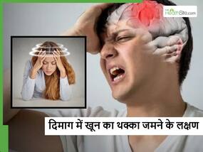 कैसे पता चलेगा दिमाग में खून के थक्के बन रहे हैं? जानें Blood Clots बनने पर कैसा महसूस होता है?