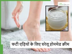 सर्दियां आते ही होने लगी Cracked heels? महंगी क्रीम के चक्कर छोड़े और घर पर बनाएं ये नेचुरल क्रीम
