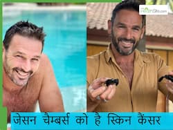 इस हॉलीवुड अभिनेता को हुआ स्किन कैंसर, धूप में ज्यादा रहने से बढ़ी बीमारी, पढ़ें पूरी खबर डिटेल में