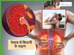 पेशाब में साफ-साफ दिखने लगते हैं Kidney Stone के ये 4 संकेत, किडनी डैमेज होने से पहले ही कर लें पहचान