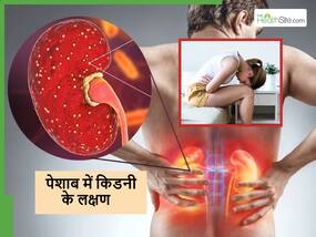 पेशाब में साफ-साफ दिखने लगते हैं Kidney Stone के ये 4 संकेत, किडनी डैमेज होने से पहले ही कर लें पहचान पेशाब में साफ-साफ दिखने लगते हैं Kidney Stone के ये 4 संकेत, किडनी डैमेज होने से पहले ही कर लें पहचान