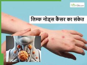 लिम्फ नोड कैंसर के ये 5 संकेत जो किसी भी व्यक्ति में देखे जा सकते हैं, इग्नोर करना हो सकता है जानलेवा लिम्फ नोड कैंसर के ये 5 संकेत जो किसी भी व्यक्ति में देखे जा सकते हैं, इग्नोर करना हो सकता है जानलेवा