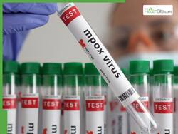Mpox Outbreak Of 2024: A Global Review Of Countries That Recorded Mpox Cases This Year