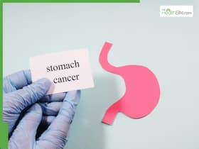 Did You Know About These 4 Common Myths Associated With Stomach Cancer? Did You Know About These 4 Common Myths Associated With Stomach Cancer?