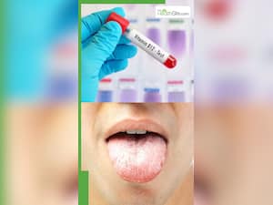 सुबह उठते ही दिखाई देते हैं विटामिन बी12 की कमी के ये लक्षण