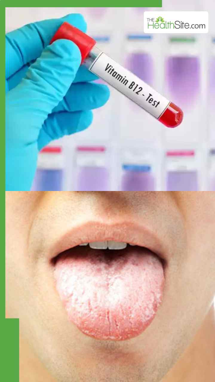 सुबह उठते ही दिखाई देते हैं विटामिन बी12 की कमी के ये लक्षण