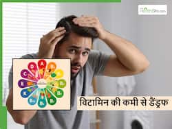सिर में बार-बार हो रहा डैंड्रफ तो सिर्फ सर्दी ही नहीं बल्कि शरीर में इस विटामिन की कमी भी हो सकती है कारण