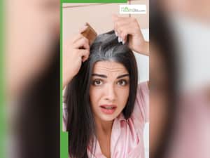 कम उम्र सफेद बाल होने के 5 बड़े कारण