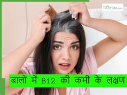 इस विटामिन की कमी से सफेद होने लगते हैं बाल, इस तरह करें कमी पूरी