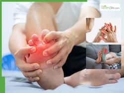 10 Signs Your Uric Acid Levels Have Gone Out of Control