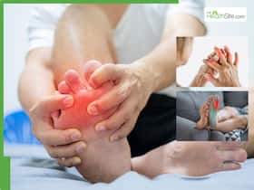 10 Signs Your Uric Acid Levels Have Gone Out of Control